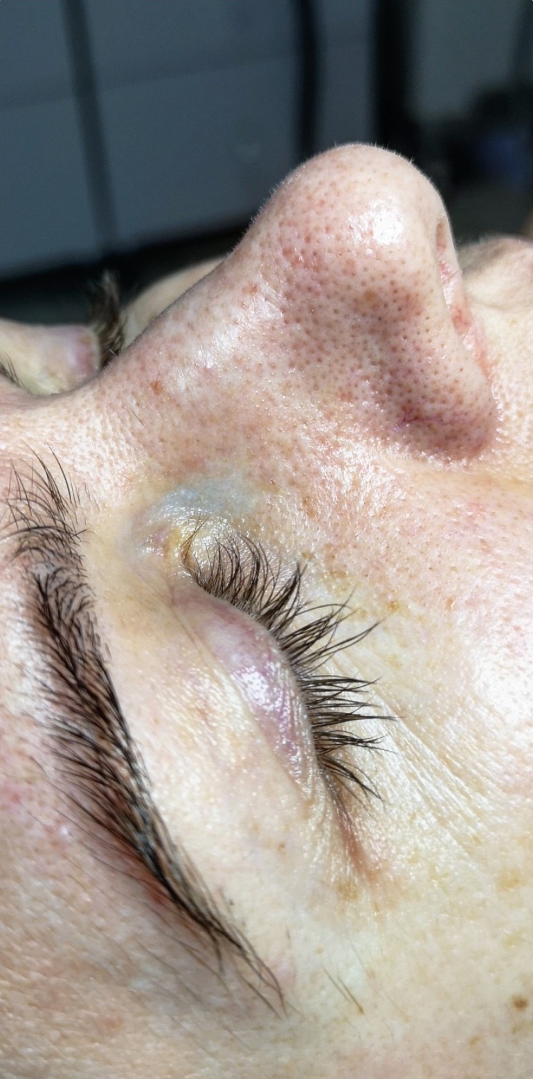 OCZYSZCZANIE_WODOROWE-1.1