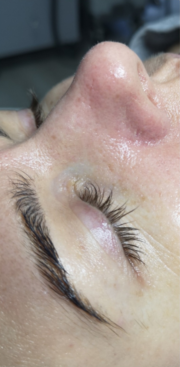 OCZYSZCZANIE_WODOROWE-1.2