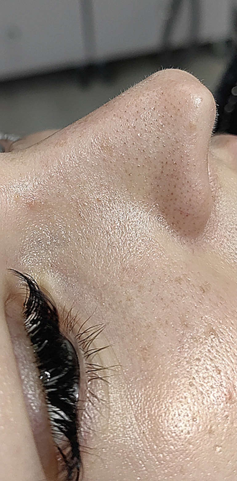 OCZYSZCZANIE_WODOROWE-2.1