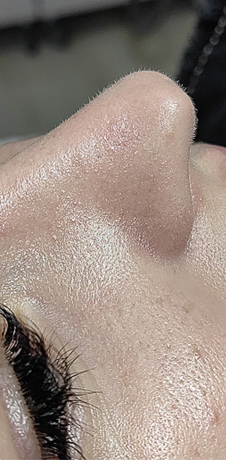 OCZYSZCZANIE_WODOROWE-2.2