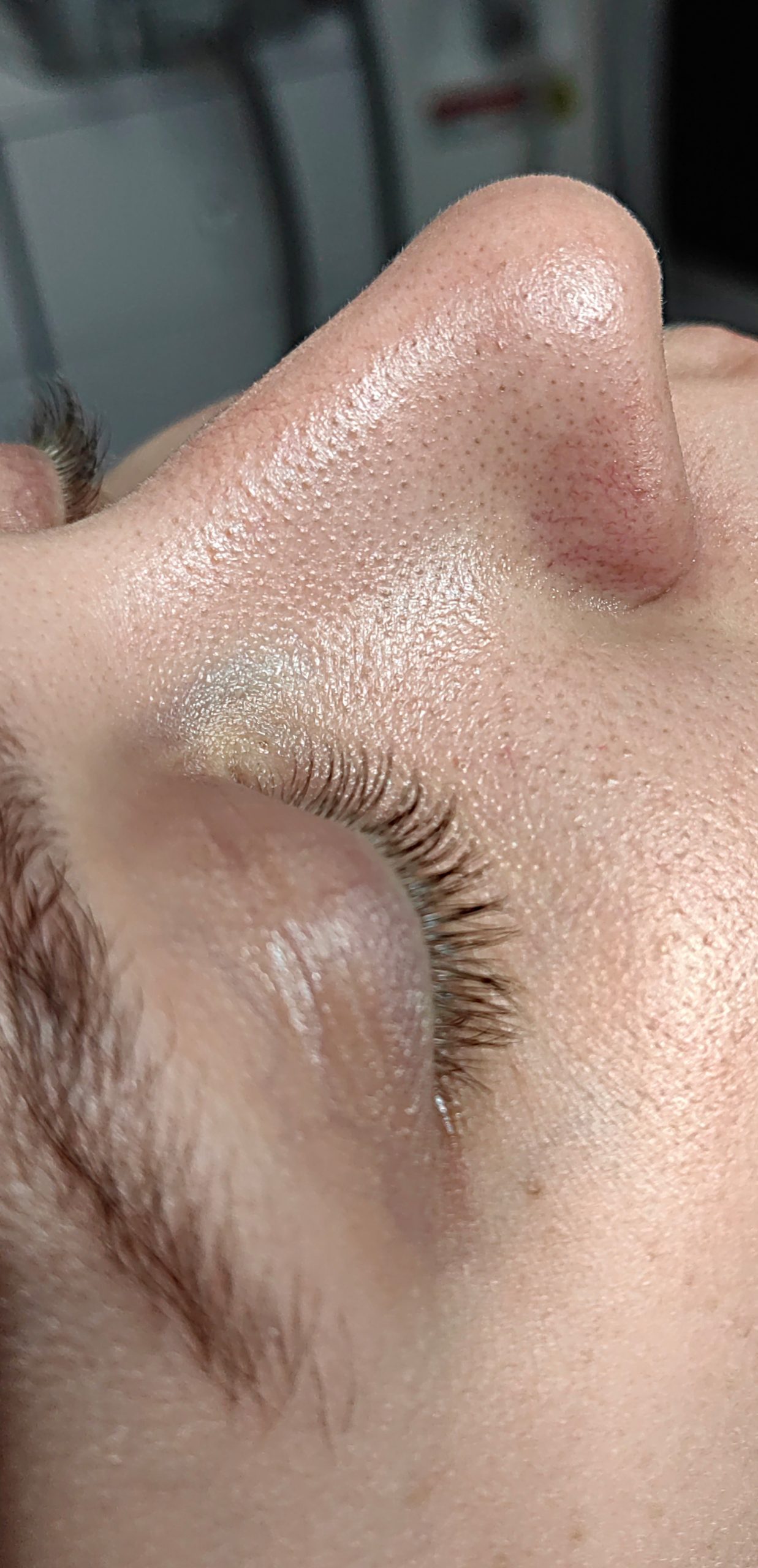 OCZYSZCZANIE_WODOROWE-3.1