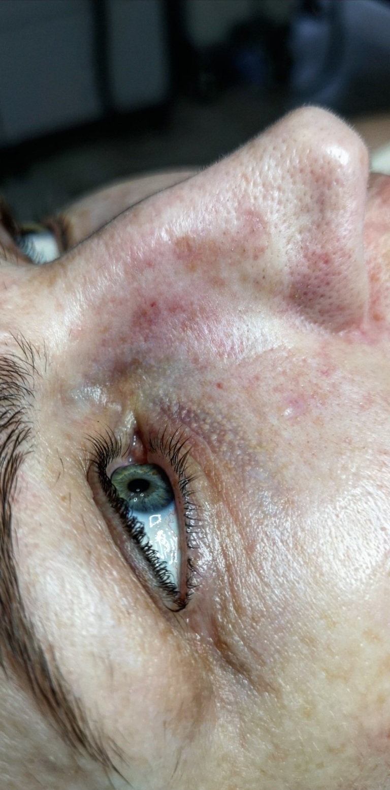 OCZYSZCZANIE_WODOROWE-4.1