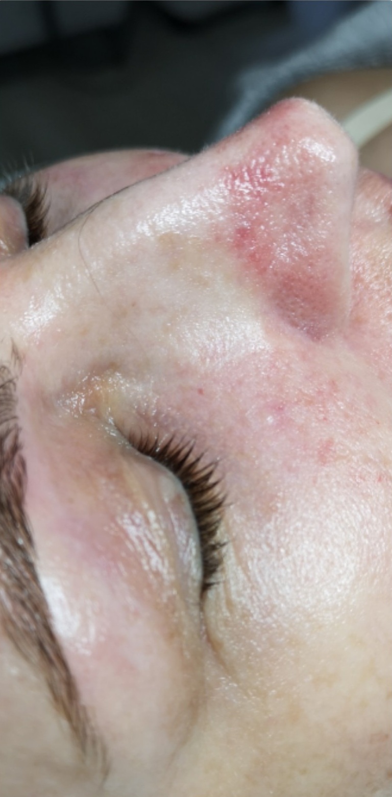 OCZYSZCZANIE_WODOROWE-4.2