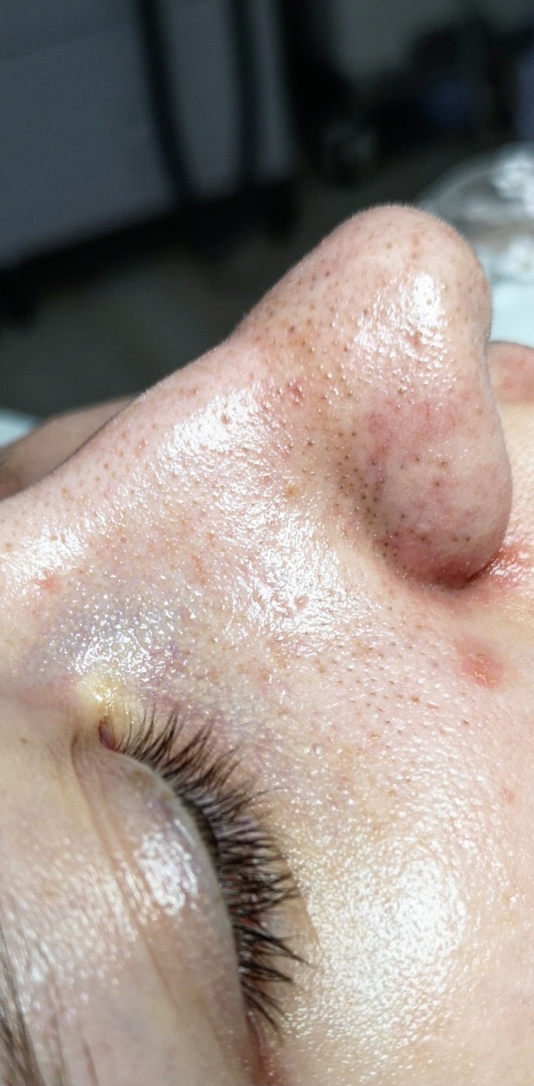 OCZYSZCZANIE_WODOROWE-5.1