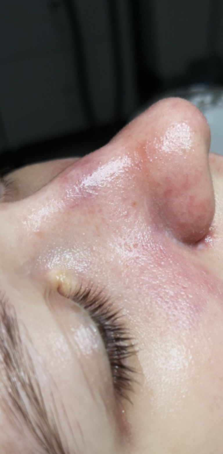 OCZYSZCZANIE_WODOROWE-5.2