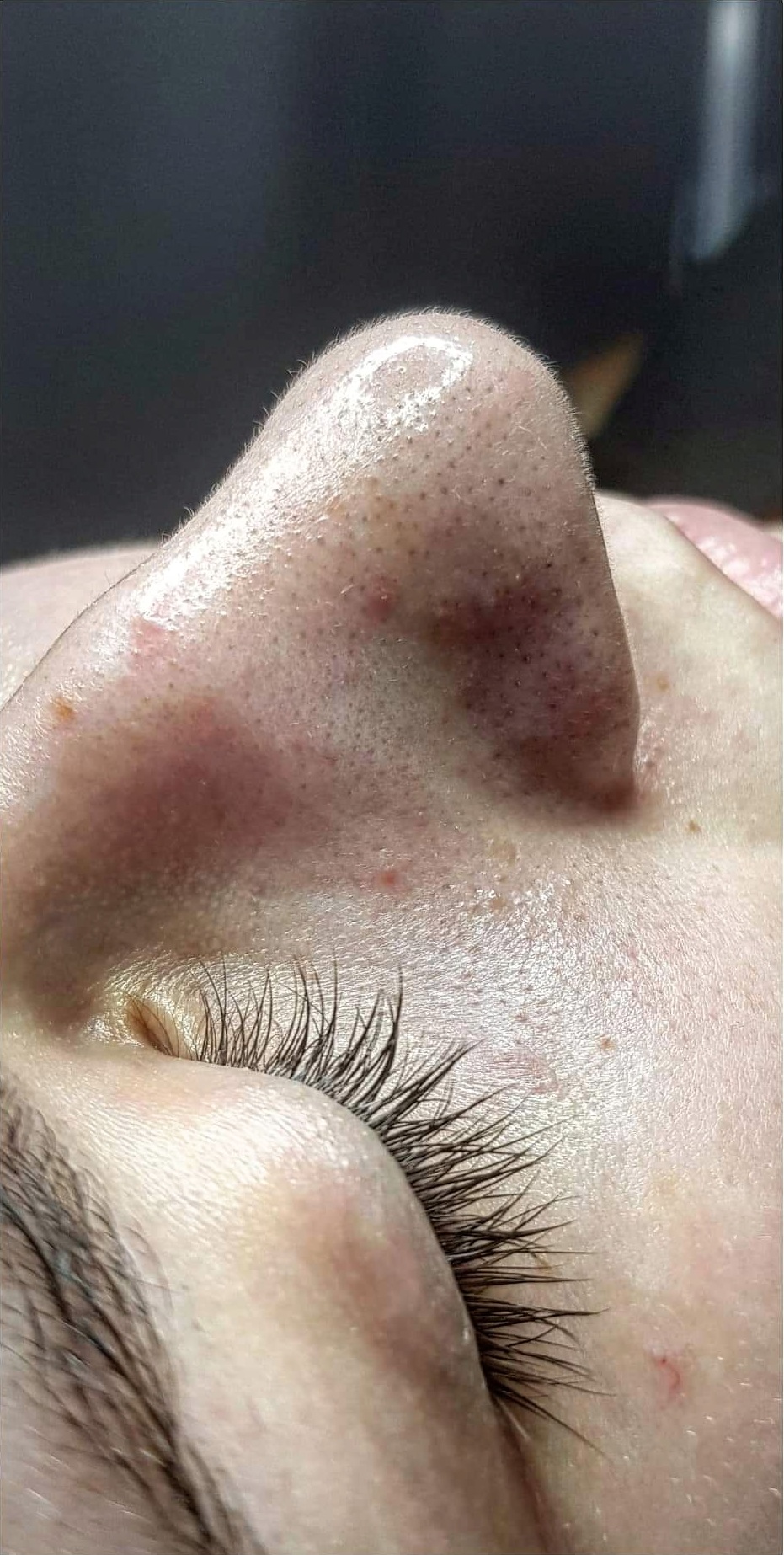 OCZYSZCZANIE_WODOROWE-6.1