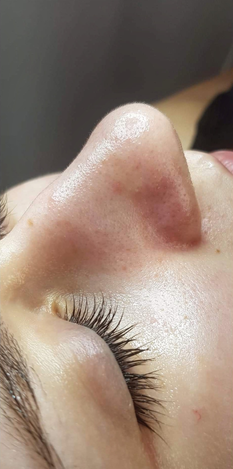 OCZYSZCZANIE_WODOROWE-6.2