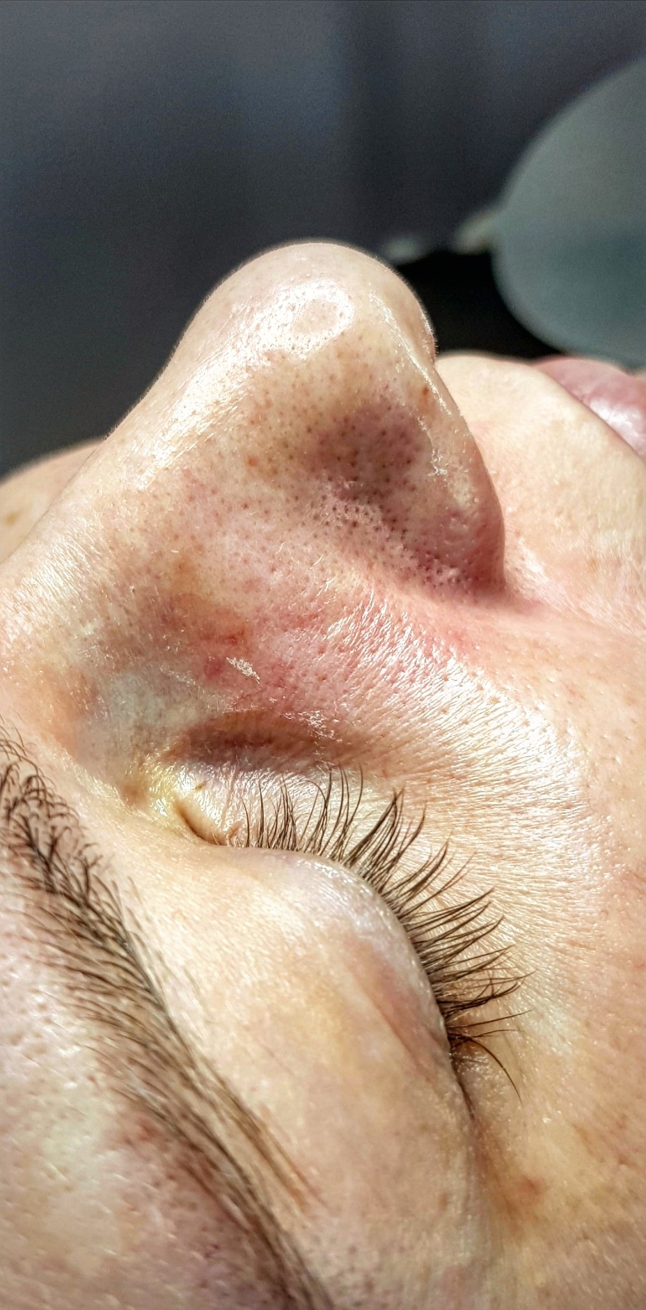 OCZYSZCZANIE_WODOROWE-7.1