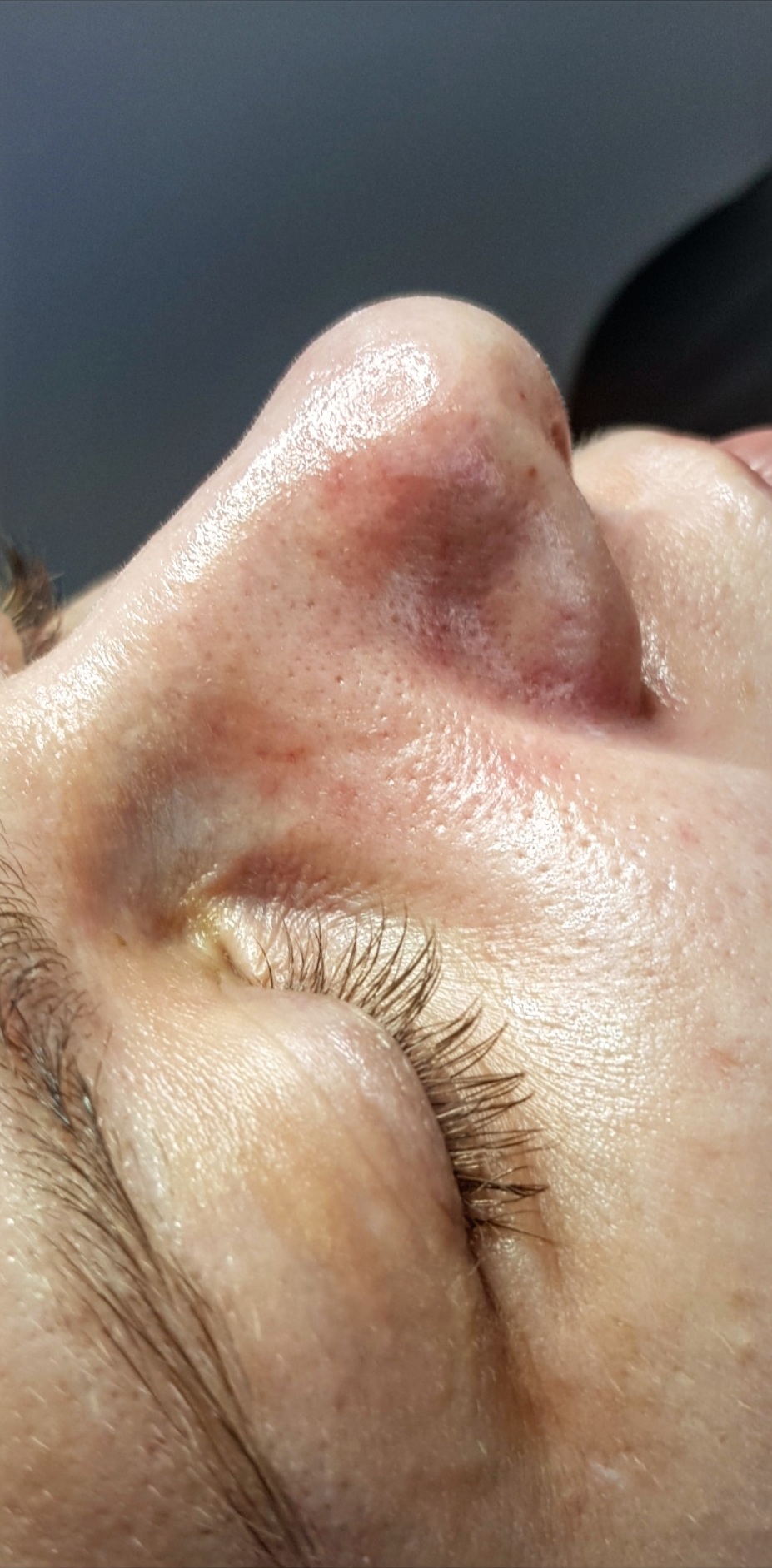 OCZYSZCZANIE_WODOROWE-7.2