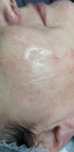 ZAMYKANIE_NACZYŃ-1.1