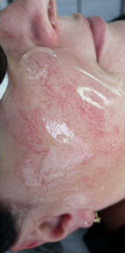 ZAMYKANIE_NACZYŃ-1.2