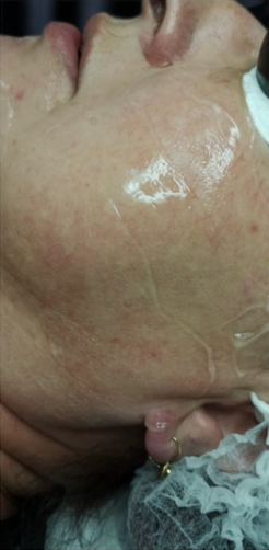 ZAMYKANIE_NACZYŃ-2.1