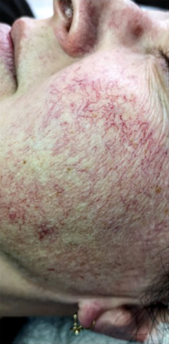 ZAMYKANIE_NACZYŃ-2.2