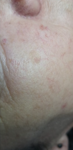 ZAMYKANIE_NACZYŃ-3.1