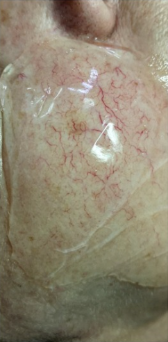 ZAMYKANIE_NACZYŃ-3.2