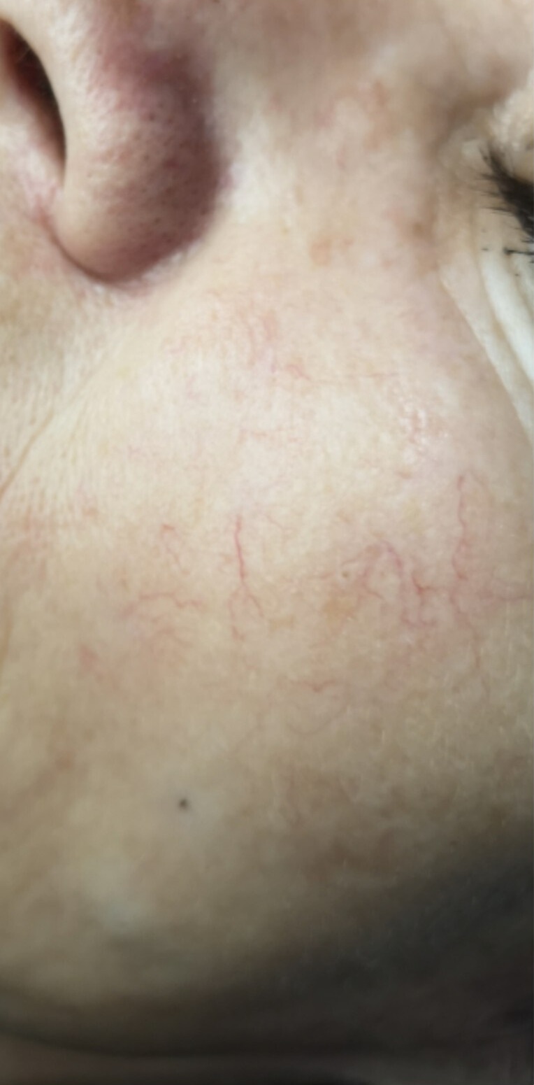 ZAMYKANIE_NACZYŃ-4.1