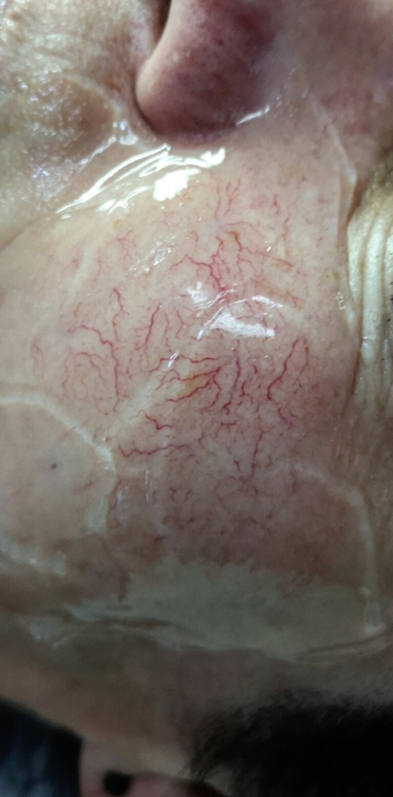 ZAMYKANIE_NACZYŃ-4.2