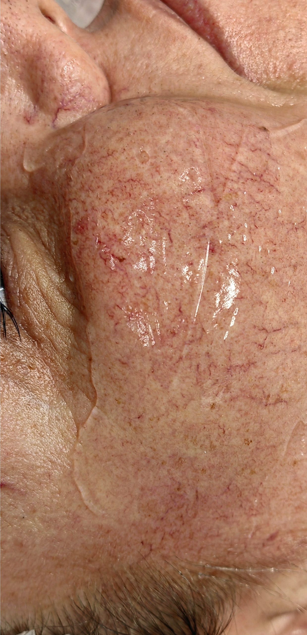 ZAMYKANIE_NACZYŃ-6.1