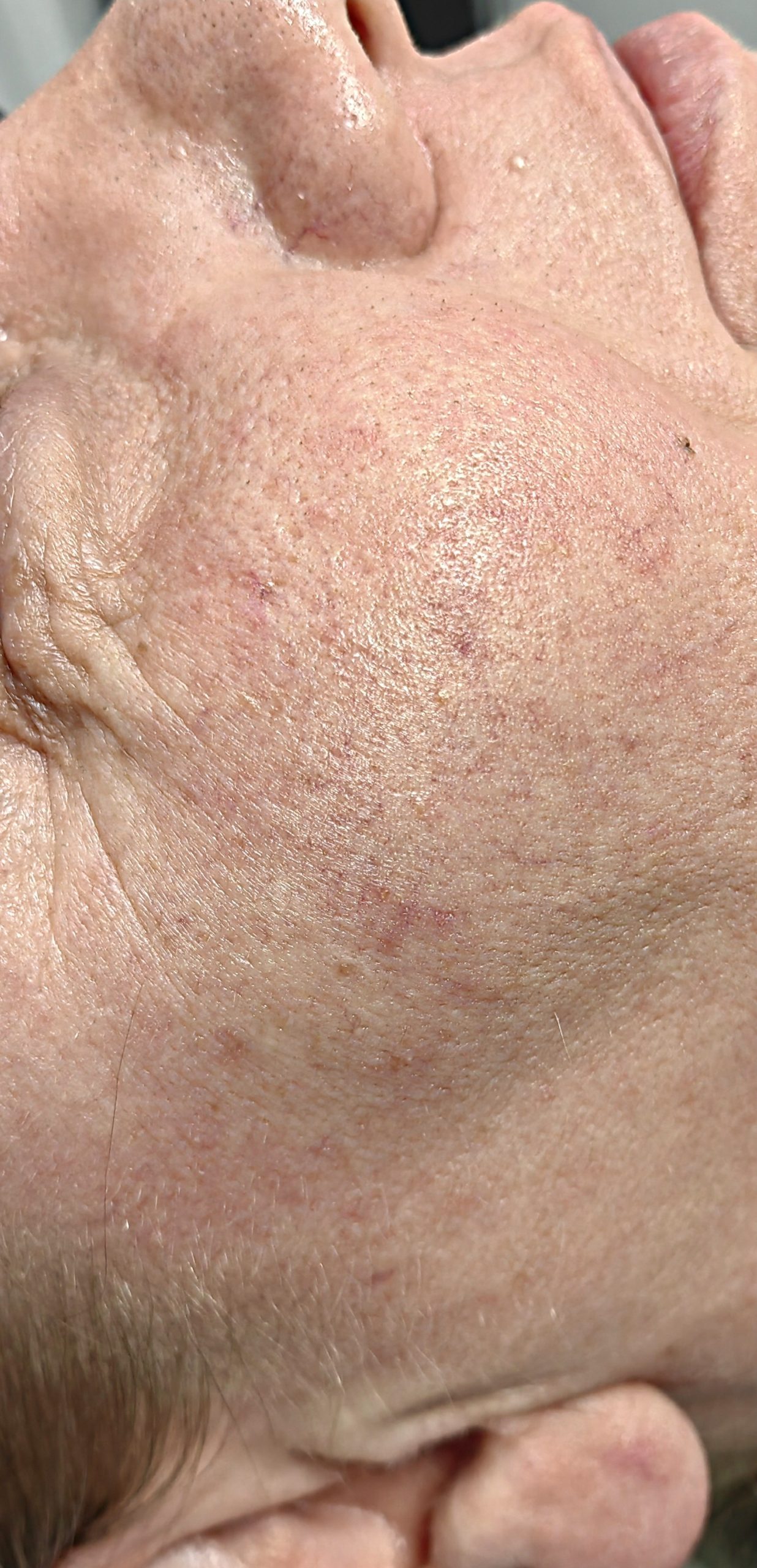 ZAMYKANIE_NACZYŃ-6.2