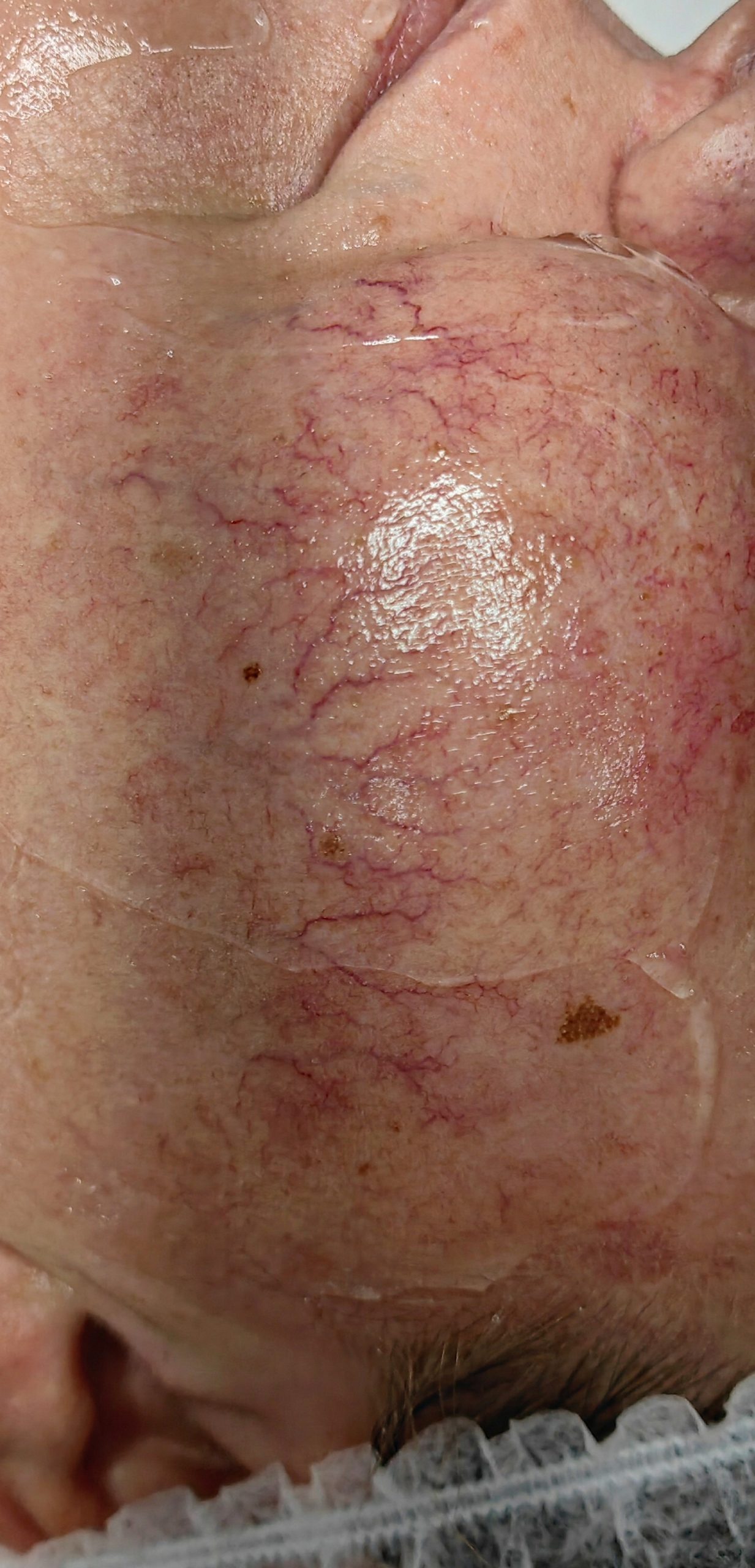 ZAMYKANIE_NACZYŃ-7.1