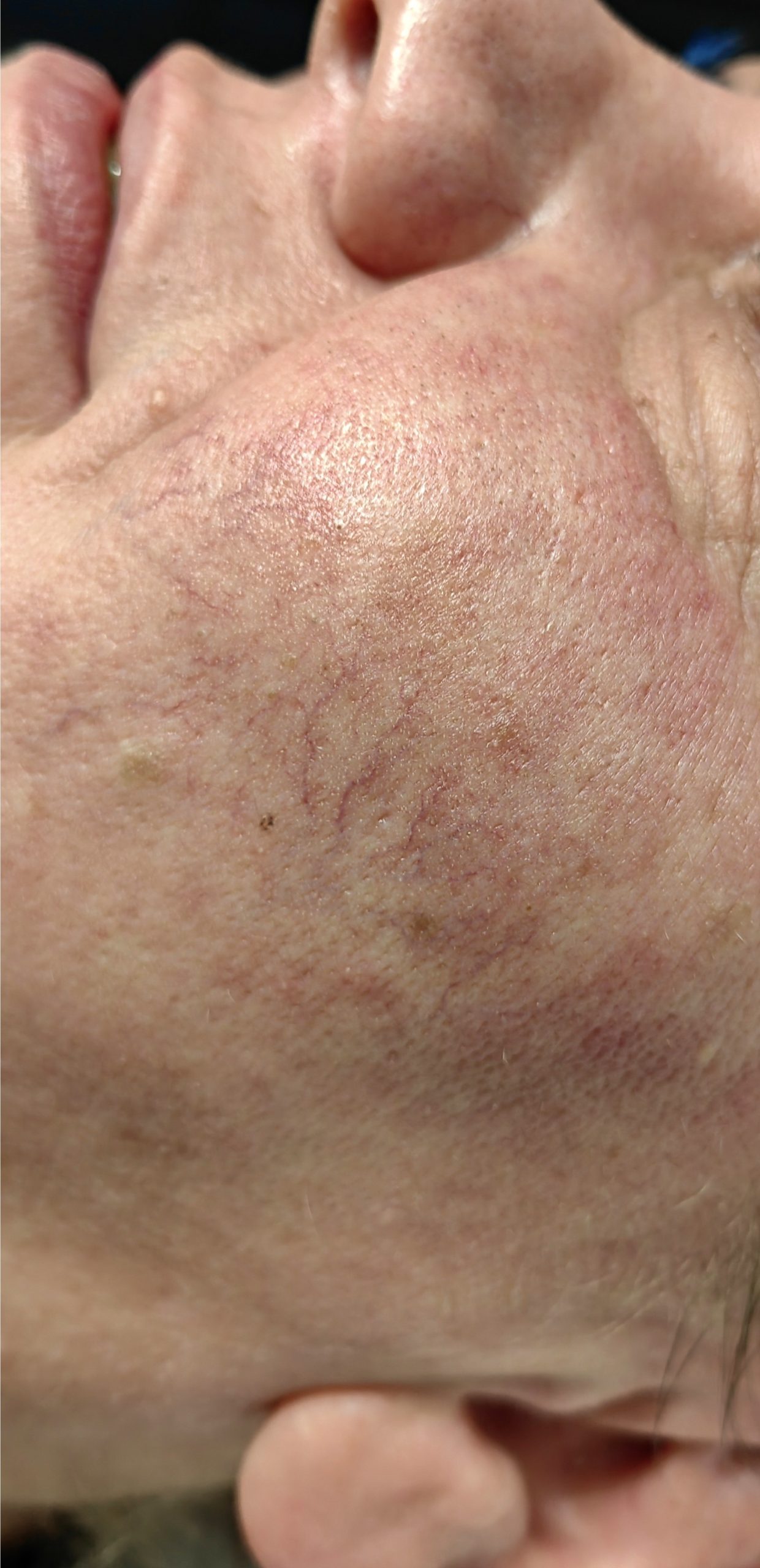 ZAMYKANIE_NACZYŃ-7.2